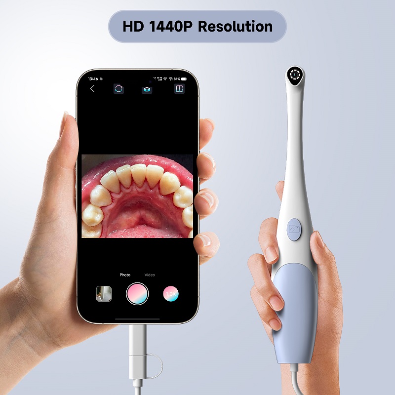 Oral Endoscope Camera 1440P Ph - Photography Lighting Products 评论和价格