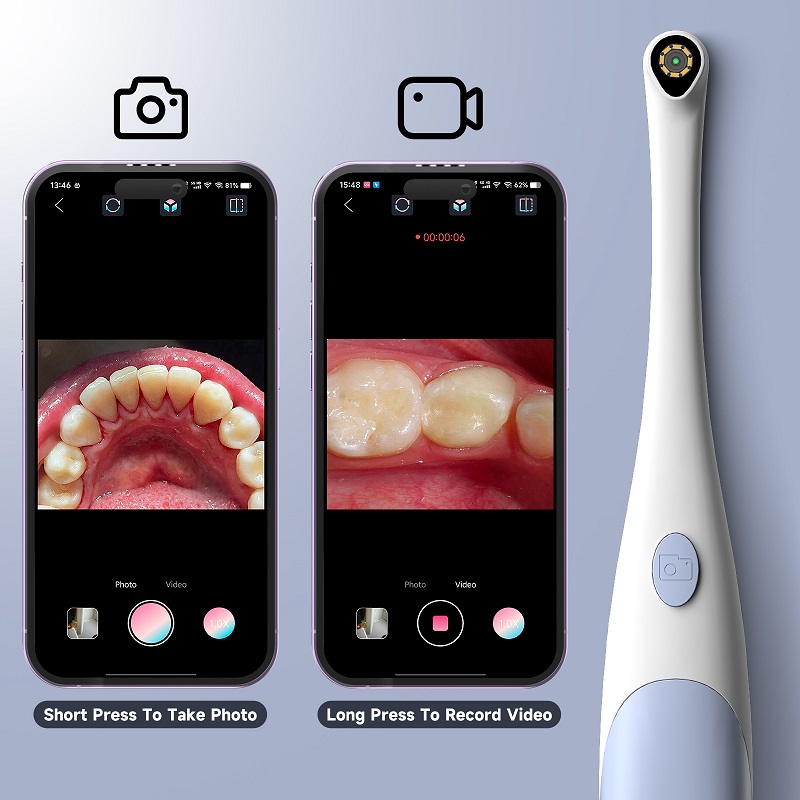 Oral Endoscope Camera 1440P Ph - Photography Lighting Products 评论和价格